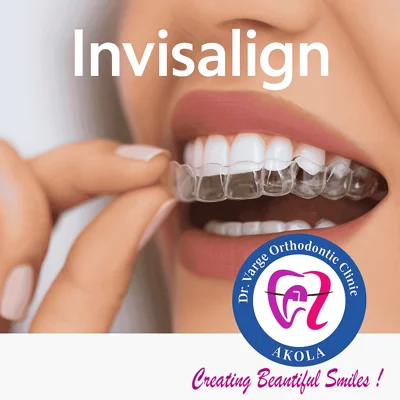 Invisalign